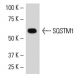 SK-LMS-1 Cell Lysate: sc-3813. Western blot analysis of SQSTM1 expression... 