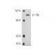 SK-LMS-1 Cell Lysate: sc-3813. Western blot analysis of Rb phosphorylation...