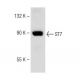 ST7 (P-12): sc-160851. Western blot analysis of ST7 expression in SK-MEL-28 whole cell lysate.