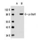 SK-MEL-28 + IFN-alpha Cell Lysate: sc-2290. Western blot analysis of... 