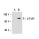 p-Stat3 Antibody (9E12) - Western Blotting - Image 18485 