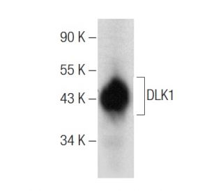 DLK1 Antibody (B-7) - Western Blotting - Image 158937 