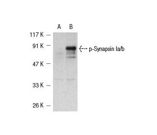 SK-N-SH + nocodazole Cell Lysate: sc-2289. Western blot analysis of... 