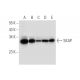 SKAP Antibody (F-11) - Western Blotting - Image 314114 
