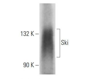 Ski Antibody (6D763) - Western Blotting - Image 18108