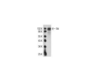 Ski Antibody (G8) - Western Blotting - Image 10979 