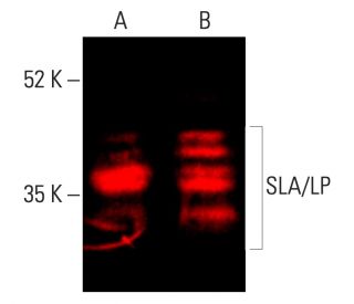 SLA/LP Antibody (E-11) - Western Blotting - Image 402091 