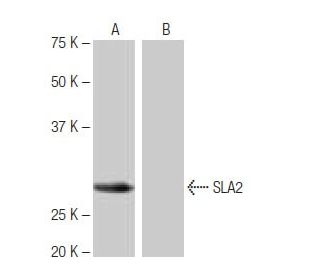SLA2 Antibody (5-RE27) - Western Blotting - Image 65052