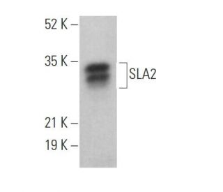 SLA2 Antibody (E-2) - Western Blotting - Image 368997 