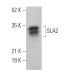 SLA2 Antibody (E-2) - Western Blotting - Image 368997 