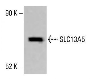 SLC13A5 Antibody (2G4) - Western Blotting - Image 414182Each CRISPR/Cas9 Knockout (KO) Plasmid product consists of a pool of 3 plasmids designed to ensure identification and cleavage of a specific gene for maximum knockout efficiency. Each plasmid encodes a unique 20 nt sequence derived from the GeCKO (v2) library.