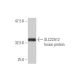 SLC22A12 Antibody (2B5) - Western Blotting - Image 350328