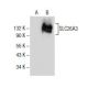SLC26A3 Antibody (H-8) - Western Blotting - Image 154528 