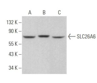 SLC26A6 Antibody (F-5) - Western Blotting - Image 371101 