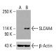DDX8 抗体(F-1):sc-515533。通过蛋白质印迹分析未处理(A)和经化学处理(B)的 HeLa 细胞完整细胞裂解物中的 DDX8 表达。β-肌动蛋白(C4):sc-47778 用作加载对照。使用的检测试剂:m-IgG Fc BP-HRP:sc-525409。 SLC4A4 Antibody (G-9) - Western Blotting - Image 416023