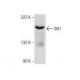 Slit1 Antibody (G-4) - Western Blotting - Image 158935