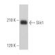 Slit1 Antibody (G-4) - Western Blotting - Image 365186 