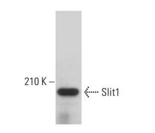 Slit1 Antibody (G-4) - Western Blotting - Image 382686 