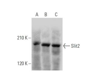Slit2 Antibody (F-7) - Western Blotting - Image 320877Each CRISPR/Cas9 Knockout (KO) Plasmid product consists of a pool of 3 plasmids designed to ensure identification and cleavage of a specific gene for maximum knockout efficiency. Each plasmid encodes a unique 20 nt sequence derived from the GeCKO (v2) library.