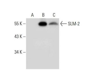 SLM-2 Antibody (E-9) - Western Blotting - Image 308031 