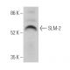 SLM-2 Antibody (E-9) - Western Blotting - Image 374630