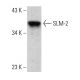 SLM-2 Antibody (E-9) - Western Blotting - Image 387376 