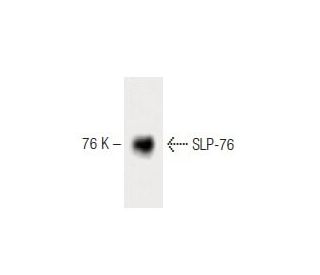 SLP-76 Antibody (8) - Western Blotting - Image 60440 