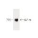 SLP-76 Antibody (8) - Western Blotting - Image 60440 