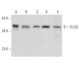 SLUG Antibody (A-7) - Western Blotting - Image 355450 