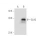 SLUG Antibody (C-7) - Western Blotting - Image 113895