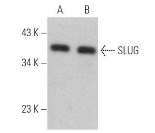 SLUG Antibody (A-7) - Western Blotting - Image 360961 
