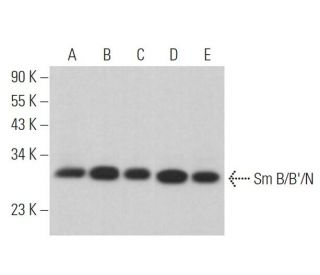 Sm B/B&prime;/N Antibody (12F5) - Western Blotting - Image 372858 