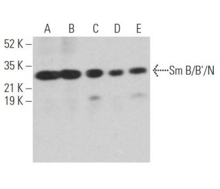 Sm B/B&prime;/N Antibody (A-10) - Western Blotting - Image 362471 
