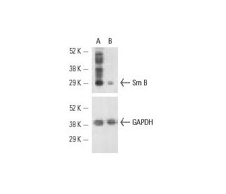 Sm B siRNA (h): sc-36503. Western blot analysis of Sm B expression in non-transfected control (A) and Sm B siRNA transfect