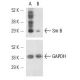 Sm B siRNA (h): sc-36503. Western blot analysis of Sm B expression in non-transfected control (A) and Sm B siRNA transfect