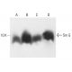 Sm G Antibody (A-11) - Western Blotting - Image 401870 