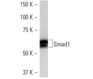 Smad1 Antibody (913C1b) - Western Blotting - Image 16768 