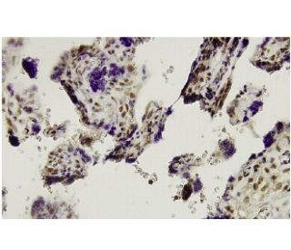 Smad2 Antibody (YZ-13) - Immunohistochemistry - Image 36317 