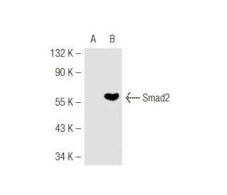 Smad2 Antibody (YZ-13) - Western Blotting - Image 47346