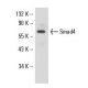 Smad4 Antibody (0.N.557) - Western Blotting - Image 17620