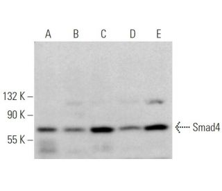 Smad4 Antibody (0.N.557) - Western Blotting - Image 374650 