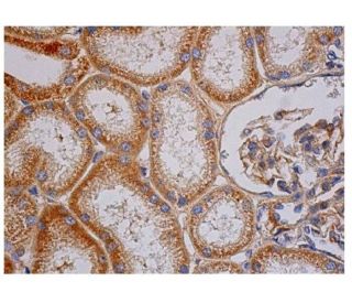 Smad4 Antibody (DCS-46) - Immunohistochemistry - Image 351504 