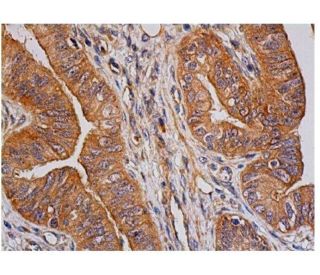 Smad4 Antibody (SMD46) - Immunohistochemistry - Image 351501 