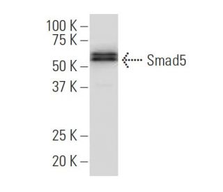 Smad5 Antibody (YY-6) - Western Blotting - Image 34511Each CRISPR/Cas9 Knockout (KO) Plasmid product consists of a pool of 3 plasmids designed to ensure identification and cleavage of a specific gene for maximum knockout efficiency. Each plasmid encodes a unique 20 nt sequence derived from the GeCKO (v2) library.