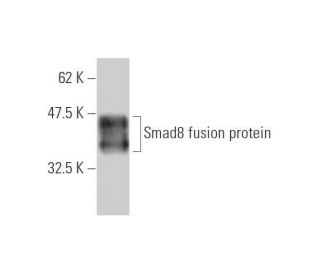 Smad8 Antibody (3E5) - Western Blotting - Image 348538