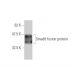 Smad8 Antibody (3E5) - Western Blotting - Image 348538
