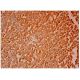 SMAP1 Antibody (H-11) - Immunohistochemistry - Image 304840 