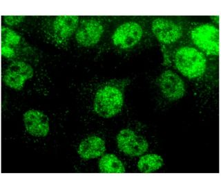 SmarcAL1 Antibody (E-12) - Immunofluorescence - Image 296395 
