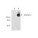 SmarcAL1 Antibody (E-12) - Western Blotting - Image 68355