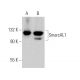 SmarcAL1 Antibody (E-12) - Western Blotting - Image 369914 